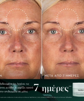 Alternative view of Nighttime Nourish Medik8